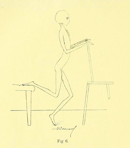 Gynecology exercises with grey aliens from 1895.