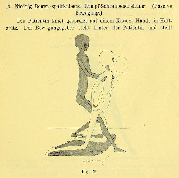 Gynecology exercises with grey aliens from 1895.