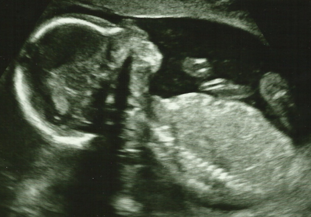 Baby ultrasound scan. Photo: Sanjin Đumišić.