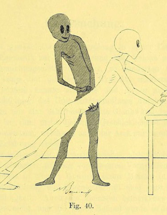 Gynaecology exercises with grey aliens from 1895